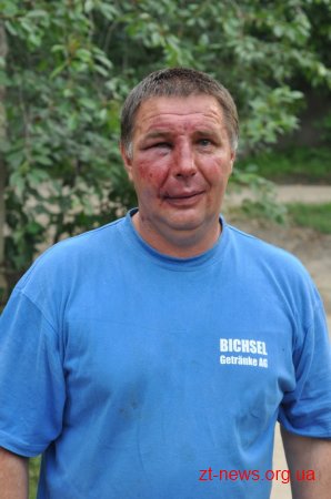 ДемАльянс знайшов нападників на активіста. Міліція – поки ні