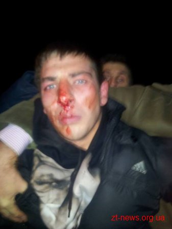 Попри наявність 5 потерпілих та 2 свідків нападу на Демальянсівців, слідчому “чомусь” не вистачає доказів