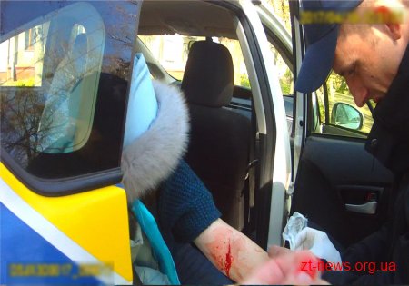 Поліцейські попередили спробу самогубства 30-річної житомирянки