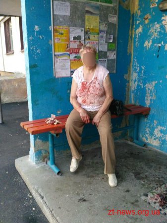 У Житомирі побились дві пенсіонерки