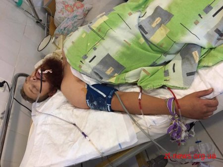 На Житомирщині стався збройний напад на підприємця