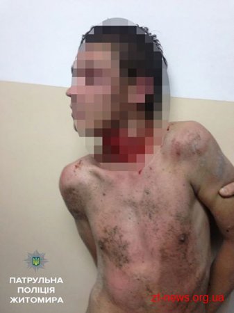 Патрульні "завадили" чоловікові кидатися камінням у перехожих