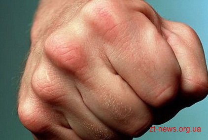 На Житомирщині син вдарив батька: пенсіонер помер в лікарні На Житомирщині син вдарив батька: пенсіонер помер в лікарні