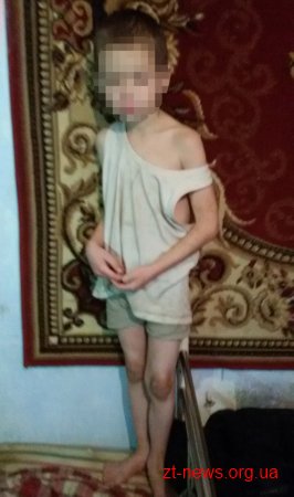 У Бердичеві мати зачинила трьох дітей в хаті на 2 дні