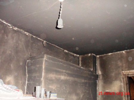На Житомирщині через дитячі пустощі з вогнем двоє малолітніх дітей опинились у реанімації