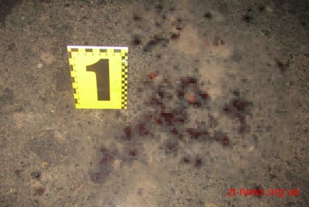 На Житомирщині під час бійки вбили 22-річного хлопця