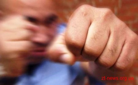 У Бердичеві чоловік у балаклаві увірвався до чужого будинку та почав бити господаря