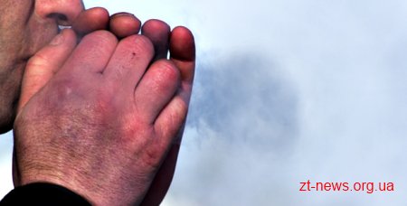 На Житомирщині двох осіб госпіталізували до лікарень через переохолодження
