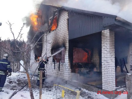 На Житомирщині внаслідок пожежі 11-річний хлопчик отримав 70% опіків тіла