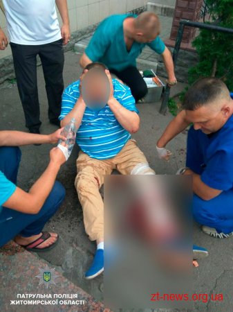 У Житомирі чаркування для одного з чоловіків закінчилося відкритим переломом ноги