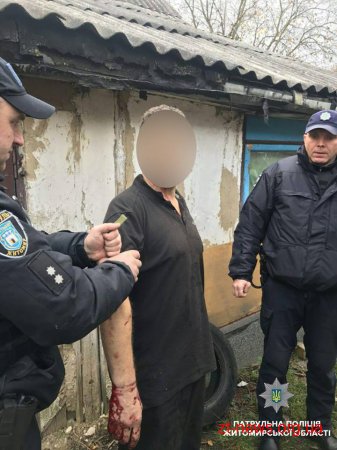 У Житомирі чоловік закрився в будинку та намагався покінчити життя самогубством