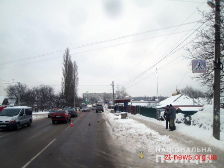 У Бердичеві на пішохідному переході автомобіль збив школяра