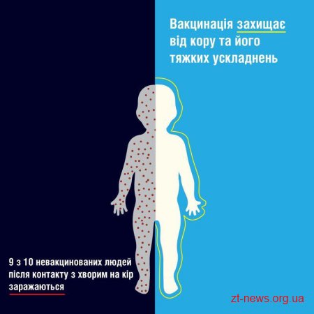 Ситуація із захворюванням на кір в місті, залишається нестійкою