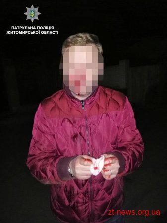У Житомирі на вул. Лесі Українки невідомий побив чоловіка та відібрав у нього мобільний