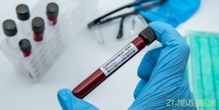 COVID-19 на Житомирщині: 14 нових випадків захворювання та 12 пацієнтів одужали