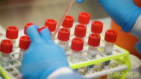 Коронавірус на Житомирщині: 8 нових випадків захворювання та 47 пацієнтів одужали