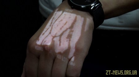 Волонтерка зібрала гроші та придбала Житомирській дитячій лікарні сканер для вен